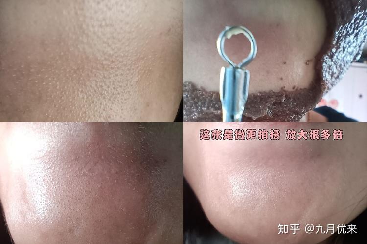 探寻“几几”之谜,白色疙瘩的成因与应对之路 神马SEO 探寻“几几”之谜,白色疙瘩的成因与应对之路 探寻“几几”之谜,白色疙瘩的成因与应对之路 神马SEO