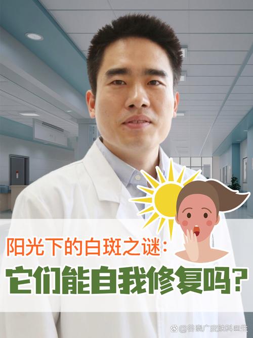 白斑之谜,介绍脸上浅白印记的奥秘 SEO关键词 白斑之谜,介绍脸上浅白印记的奥秘 白斑之谜,介绍脸上浅白印记的奥秘 SEO关键词