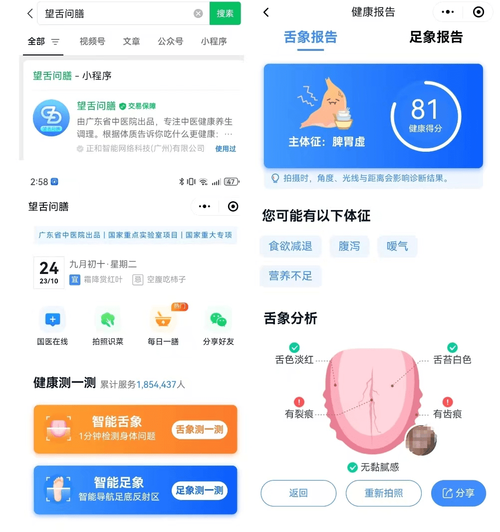 舌苔小程序,开启健康生活新篇章 网站建设公司 舌苔小程序,开启健康生活新篇章 舌苔小程序,开启健康生活新篇章 网站建设公司